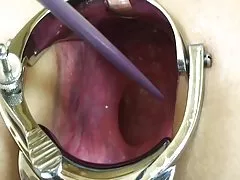 Linda anal sexo selvagem na rua russa com magrinha gostosa